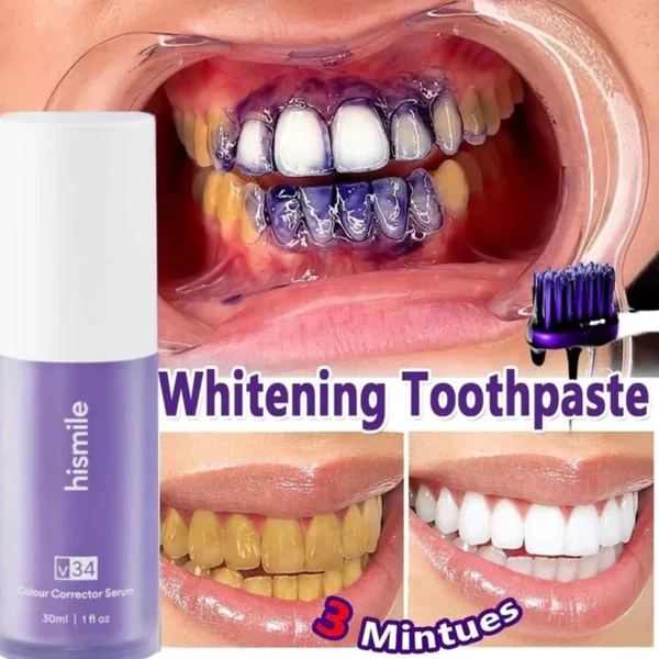 Teeth Whitening